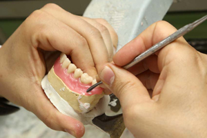 ProtÃ©sicos dentales Madrid