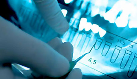 implantes dentales Madrid precios